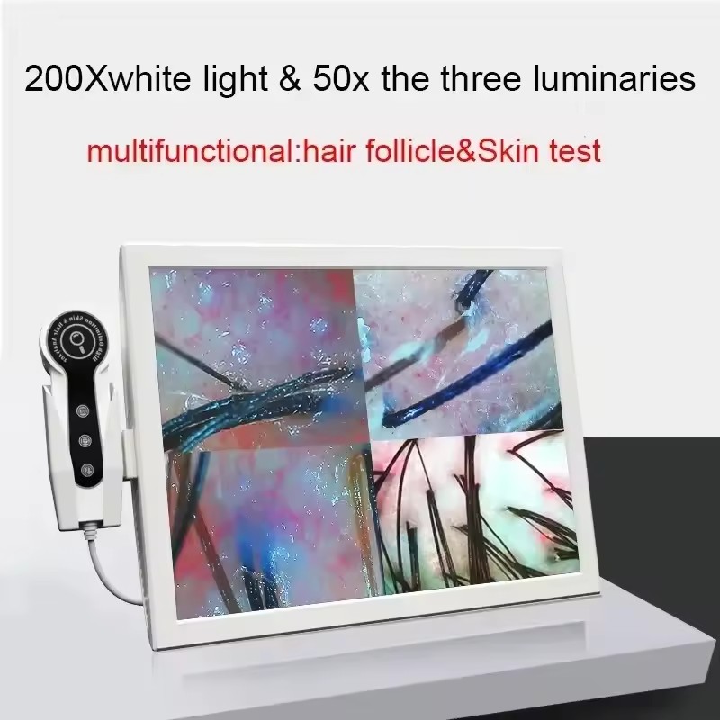 Skin Moisture Analyzer Digital Detector - HDデジタル皮膚分析器プロフェッショナル頭皮カメラ検出器毛包油分水分テストデバイス15インチ2026