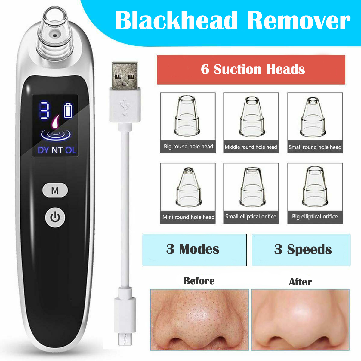 Blackhead Remover Vacuum Suction - 電動ブラックヘッドリムーバー 深層洗浄 毛穴クリーナー フェイスノーズ ブラックヘッド ニキビ除去機