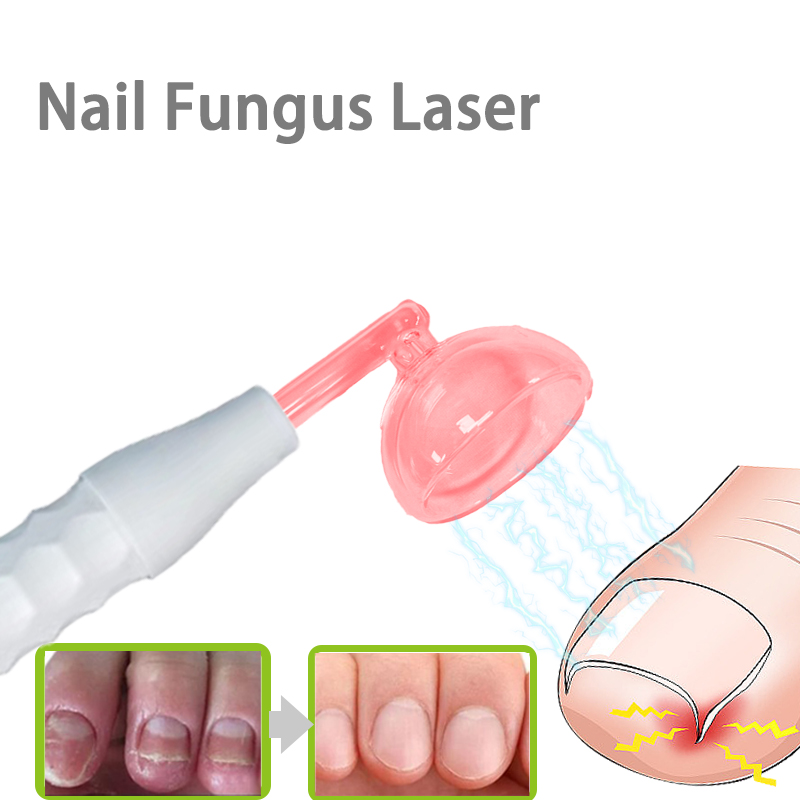 High Frequency Wand Facial Machine Neon - 高周波フェイシャルマシン電気療法ワンドガラスネオン+アルゴンワンド炎症治療爪真菌症治療