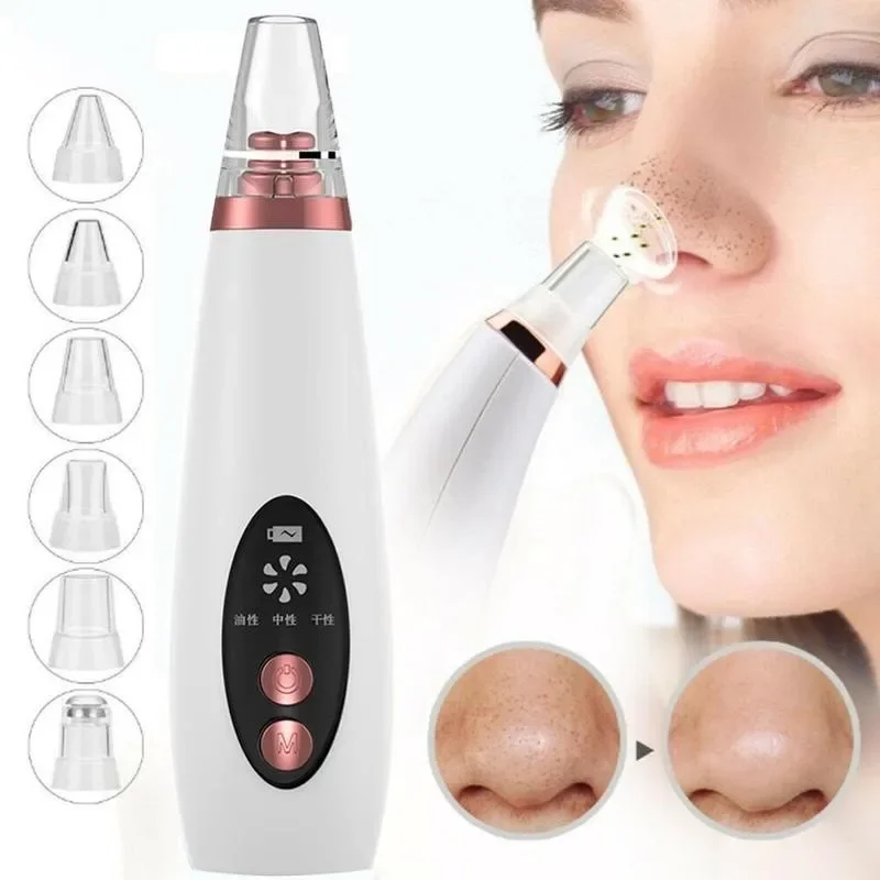 Blackhead Remover Vacuum Suction - 黒ずみ除去真空吸引器 電動毛穴クリーナー フェイシャル吸引ツール USB充電式 5ヘッド 家庭用スキンケアデバイス