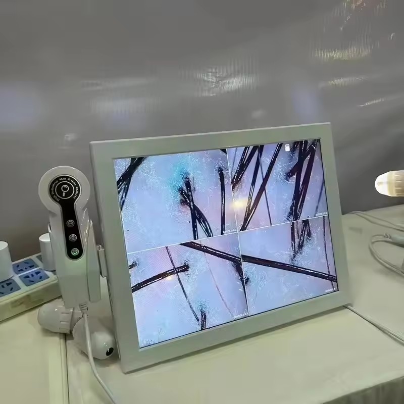 HDデジタル皮膚分析器プロフェッショナル頭皮カメラ検出器毛包 - Skin Moisture Analyzer Digital Detector のレビューと価格
