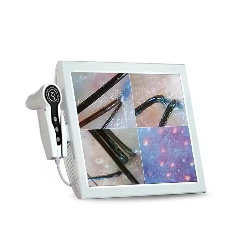 HDデジタル皮膚分析器プロフェッショナル頭皮カメラ検出器毛包 - Skin Moisture Analyzer Digital Detector のレビューと価格