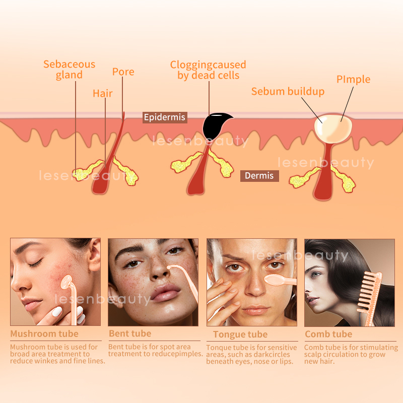 ダルソンバル新型高周波フェイシャルマシン、7種類のネオン＆ア - High Frequency Wand Facial Machine Neon のレビューと価格