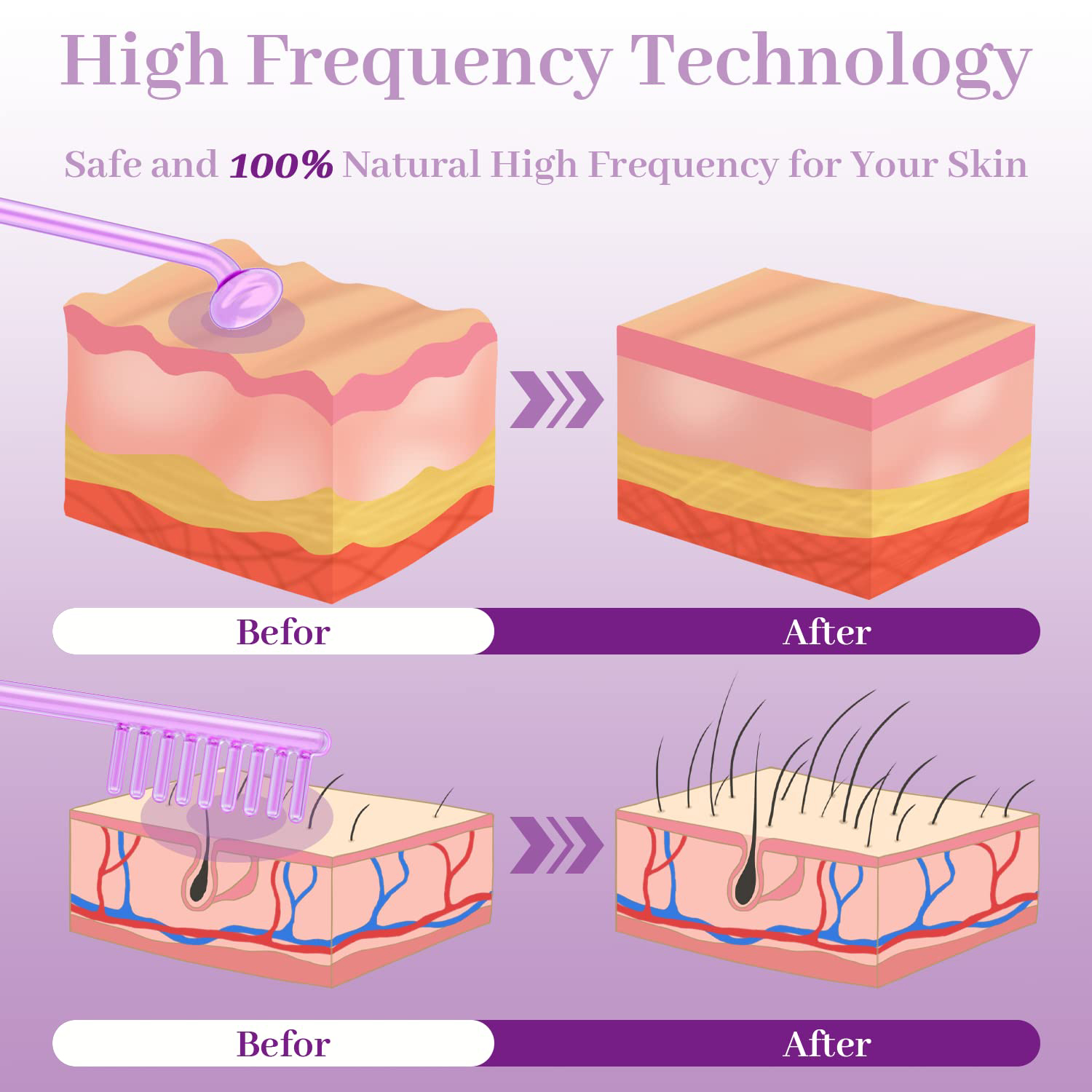 4in1高周波電極ワンド、ネオン電気療法用ガラス管、ニキビ除 - High Frequency Wand Facial Machine Neon のレビューと価格