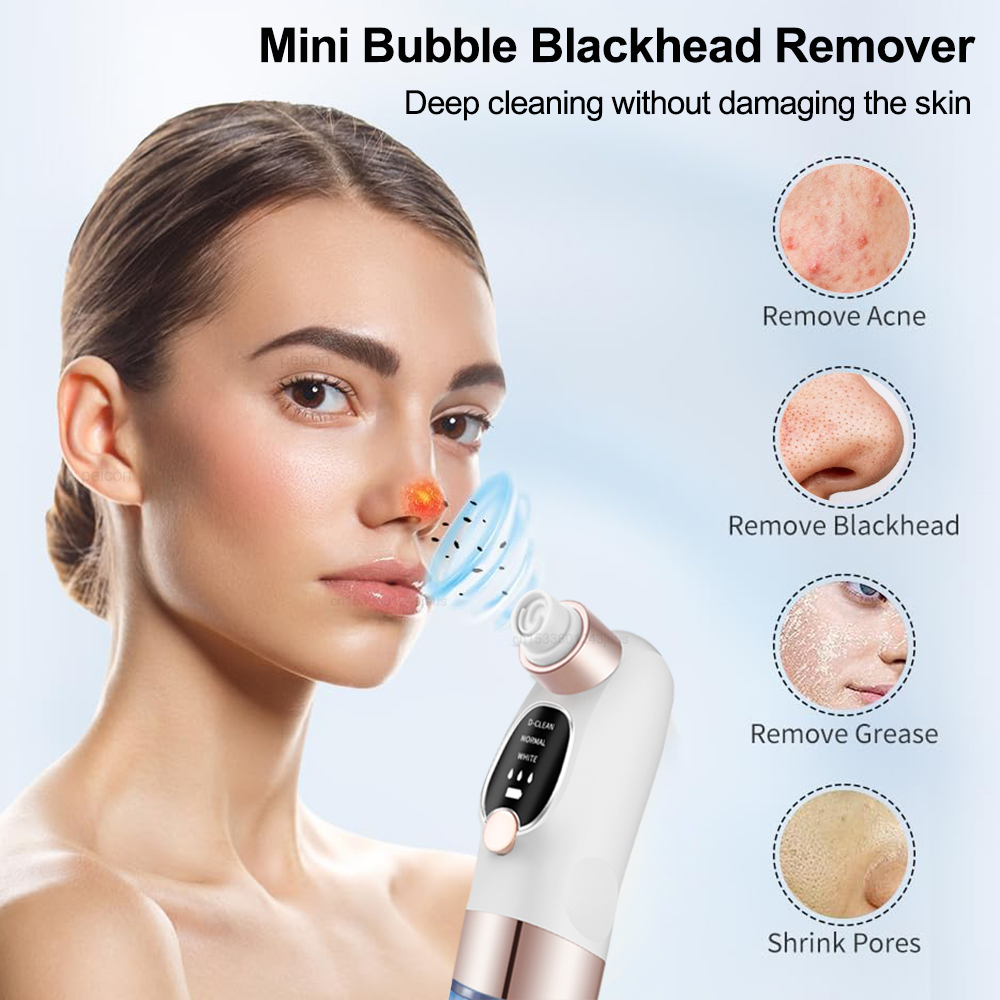 電気にきびリムーバー真空顔毛穴クリーナー充電式ディープダート - Blackhead Remover Vacuum Suction のレビューと価格