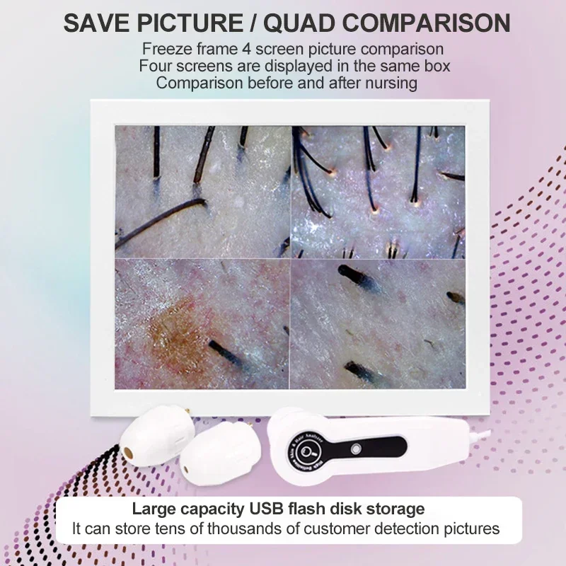 2025年 HDデジタルスキンアナライザー プロ仕様 頭皮カ - Skin Moisture Analyzer Digital Detector のレビューと価格