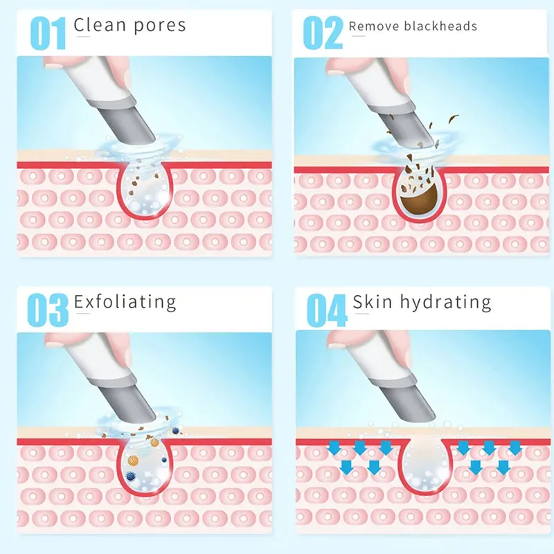 新型ピーリング美容機器 新型小型バブル酸素注入器 ハイドラダ - Hydra Dermabrasion Aqua Peel Machine のレビューと価格