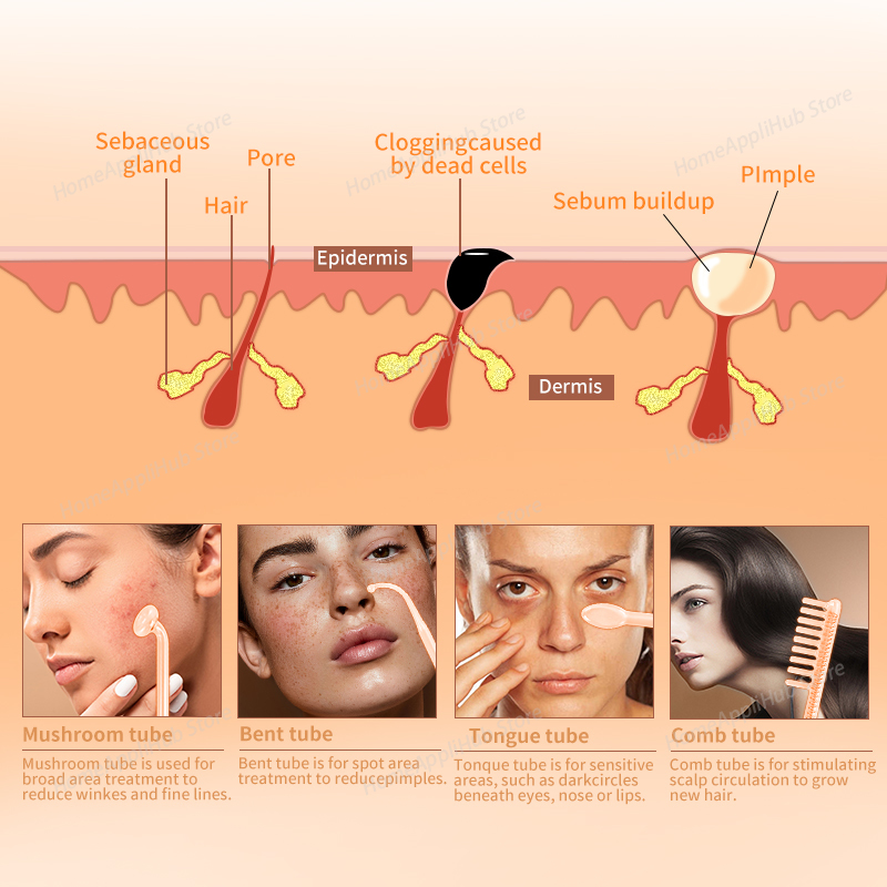 ダルソンバル ポータブル高周波美顔器 スキンセラピー 4つの - High Frequency Wand Facial Machine Neon のレビューと価格