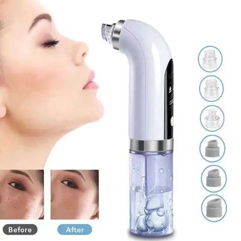 毛穴を清掃し、ニキビを除去できる、真空吸引機能付きの携帯型毛 - Blackhead Remover Vacuum Suction のレビューと価格