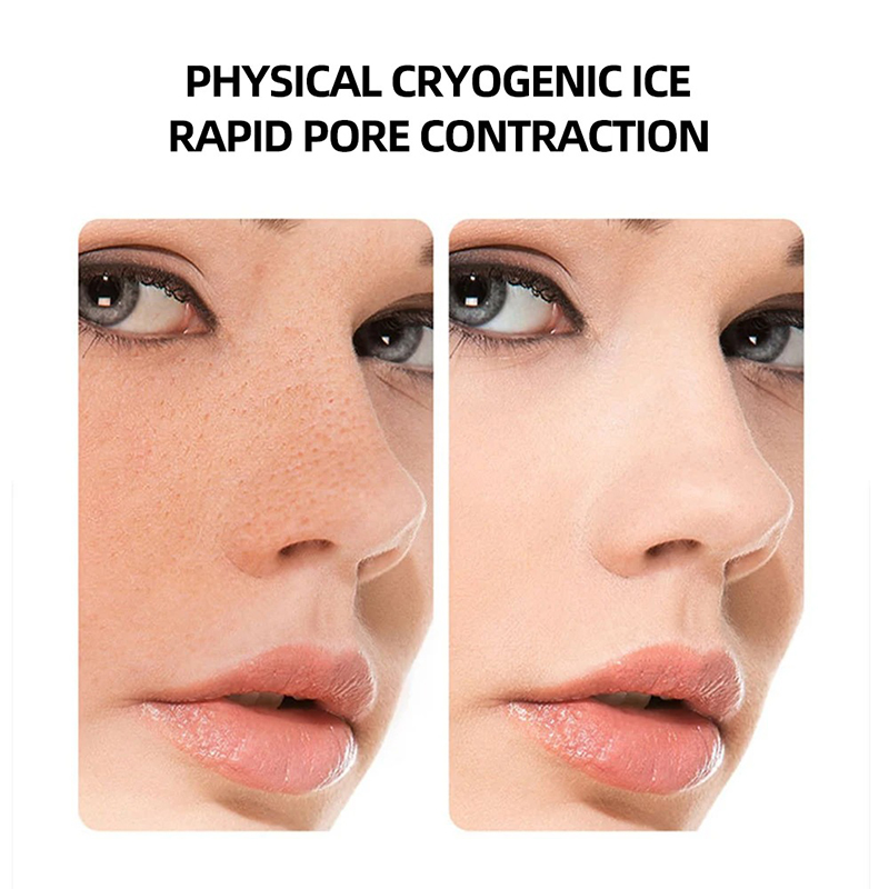 ホットコールドハンマーホームフェイシャルマッサージャー導入装 - Cold Warm Hammer Facial Machine のレビューと価格
