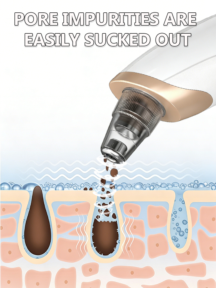 電動毛穴クリーナー ブラックヘッド除去真空デバイス 3段階吸 - Blackhead Remover Vacuum Suction のレビューと価格