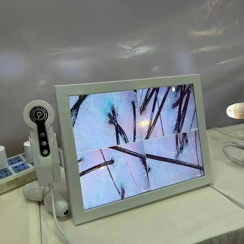 2025 HDデジタルスキンアナライザー プロ仕様 頭皮カメ - Skin Moisture Analyzer Digital Detector のレビューと価格