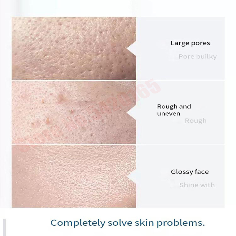 ハイドラセラムソリューション フェイシャルディープクレンジン - Hydra Dermabrasion Aqua Peel Machine のレビューと価格