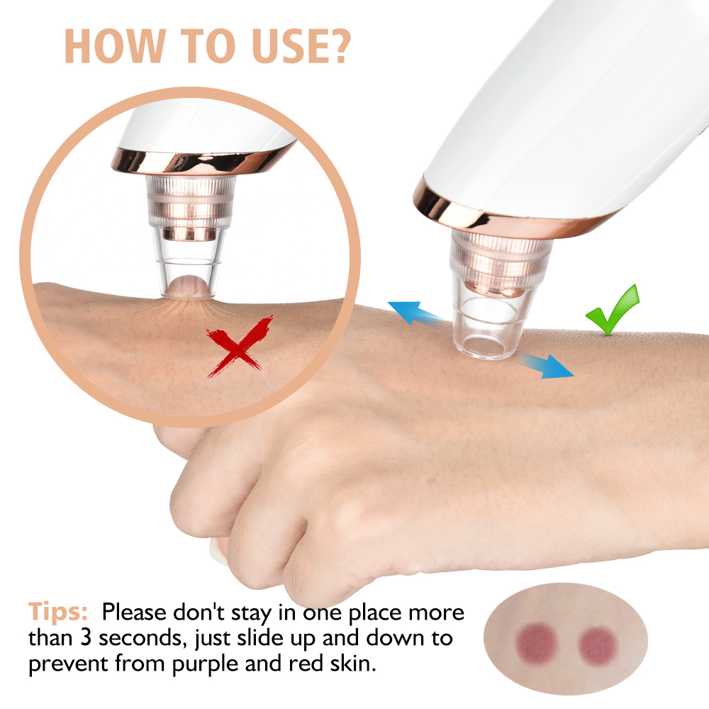 にきびやにきび用の掃除機,毛穴をきれいにするフェイシャルクレ - Blackhead Remover Vacuum Suction のレビューと価格