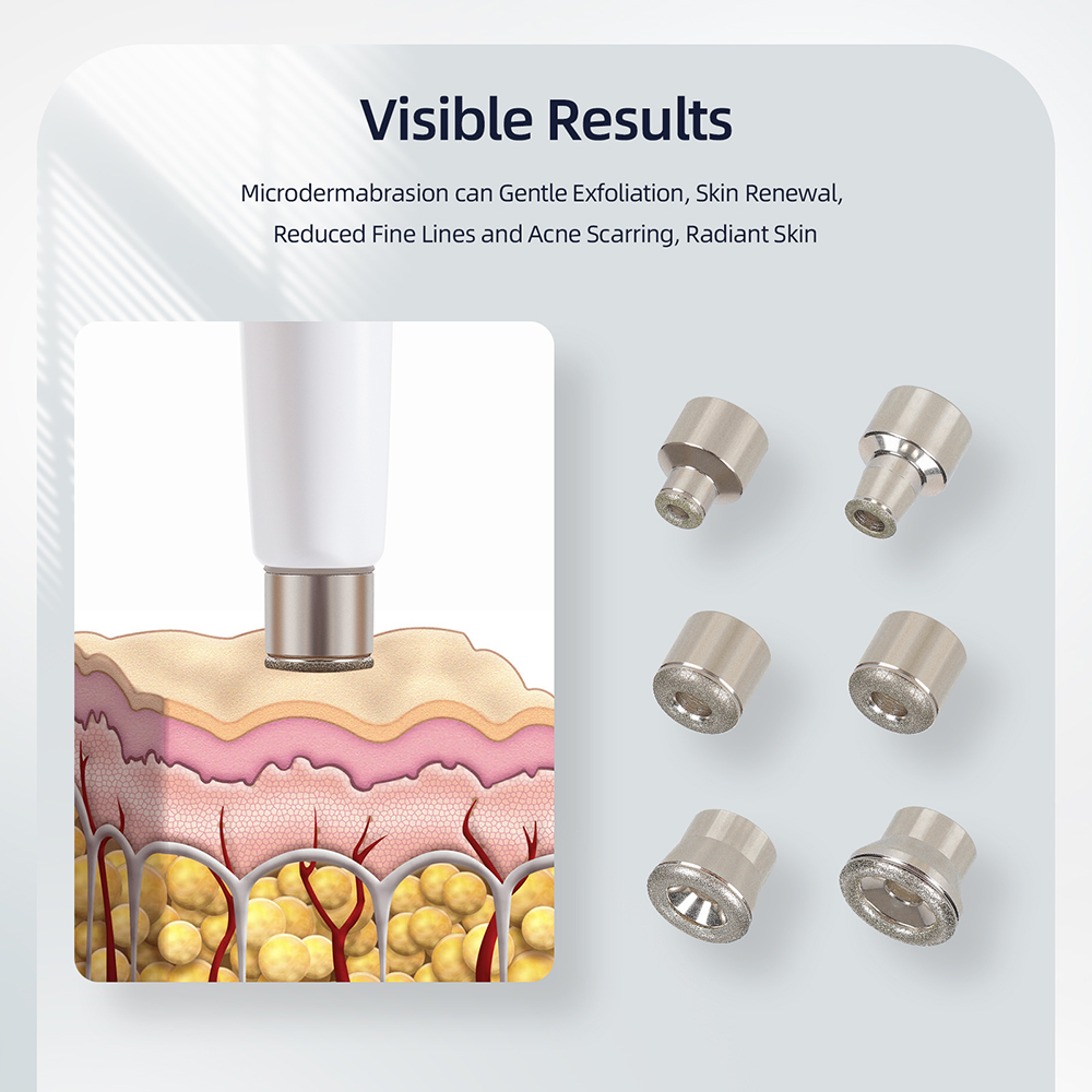 3in1ダイヤモンドマイクロダーマブレーションマシン。顔の角 - Diamond Microdermabrasion Machine 3 In 1 のレビューと価格