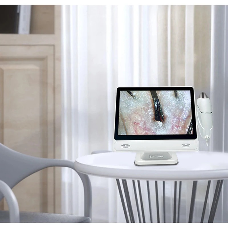 2026年プロ仕様ヘア頭皮カメラ検出器HDデジタル肌分析器毛 - Skin Moisture Analyzer Digital Detector のレビューと価格