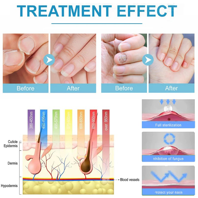 高周波フェイシャルマシン電気療法ワンドガラスネオン+アルゴン - High Frequency Wand Facial Machine Neon のレビューと価格