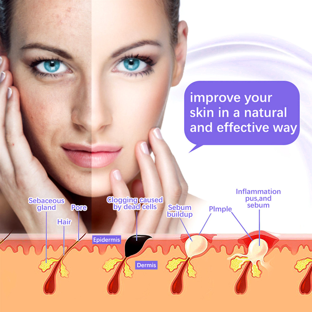 7 in 1高周波フェイシャルケアマシン電気療法ワンド電気オ - High Frequency Wand Facial Machine Neon のレビューと価格