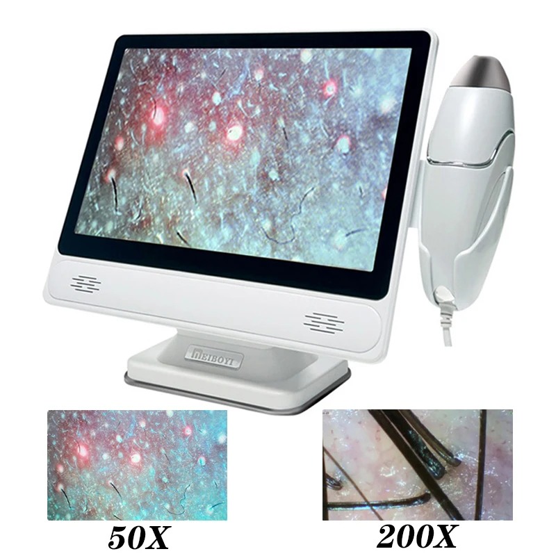 HDデジタル肌分析器 プロ仕様 頭皮カメラ 検出器 毛包油分 - Skin Moisture Analyzer Digital Detector のレビューと価格